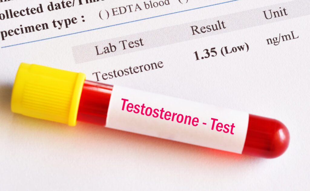 at home hormone test kit