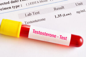 An At Home Hormone Test Kit Is Essential After SARMs Or Steroid Use