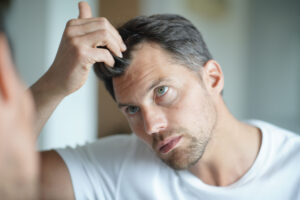does whey protein cause hair loss